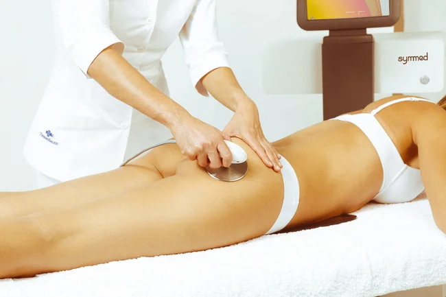 Tratamiento de radiofrecuencia Symmed Termosalud en Gijón